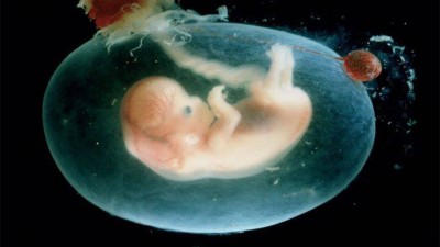 К чему снится эмбрион (зародыш)? Сонник Эмбрион (Зародыш)