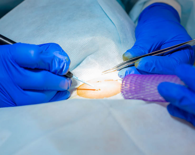 Оперативно и без очередей: как найти опытного хирурга в Казани